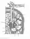 Fig. 03 - Interbody fusion implant and related methods