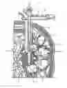 Fig. 15 - Interbody fusion implant and related methods