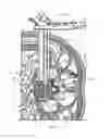 Fig. 16 - Interbody fusion implant and related methods