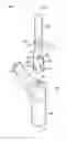 Fig. 01 - Modular proximal body trial