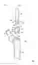 Fig. 02 - Modular proximal body trial