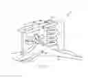 Fig. 28 - Quasi-Active Prosthetic Joint System