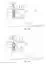 Fig. 18 - Quasi-Active Prosthetic Joint System