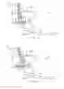 Fig. 19 - Quasi-Active Prosthetic Joint System