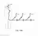 Fig. 11 - Method of manufacturing implants