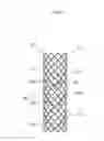 Fig. 09 - BIODEGRADABLE DOUBLE STENT