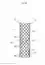Fig. 10 - BIODEGRADABLE DOUBLE STENT