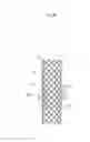 Fig. 11 - BIODEGRADABLE DOUBLE STENT