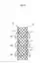 Fig. 12 - BIODEGRADABLE DOUBLE STENT