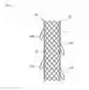 Fig. 13 - BIODEGRADABLE DOUBLE STENT
