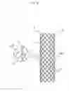 Fig. 15 - BIODEGRADABLE DOUBLE STENT