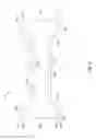 Fig. 04 - Inflatable balloon stent