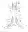 Fig. 01 - Internal iliac preservation devices and methods