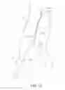 Fig. 10 - Internal iliac preservation devices and methods