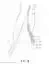 Fig. 13 - Internal iliac preservation devices and methods