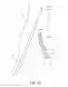 Fig. 15 - Internal iliac preservation devices and methods