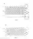 Fig. 03 - Releasable vascular device connection