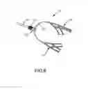 Fig. 05 - Releasable vascular device connection