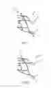 Fig. 06 - Releasable vascular device connection