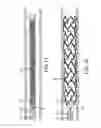 Fig. 10 - Releasable vascular device connection