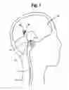 Fig. 02 - Methods and devices for treating obesity, incontinence, and neurological and physiological disorders