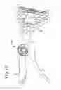 Fig. 04 - ADJUSTABLE CERVICAL COLLAR