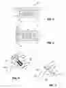 Fig. 04 - Ophthalmic shunt and method
