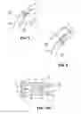 Fig. 05 - Ophthalmic shunt and method
