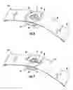 Fig. 07 - Ring compression bandage