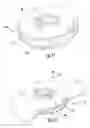 Fig. 10 - Ring compression bandage