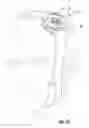 Fig. 13 - Ring compression bandage