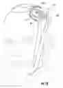 Fig. 15 - Ring compression bandage
