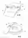 Fig. 17 - Ring compression bandage