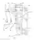 Fig. 02 - Suspension-Based Walking Assistance Aide Apparatus
