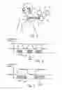 Fig. 02 - System for respiratory disorder therapy with selection of stimulation strategies
