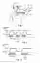 Fig. 02 - System for respiratory disorder therapy with stabilization control of stimulation