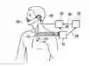 Fig. 01 - Device for optimization of sleep apnea syndrome therapy by kinesthetic stimulation