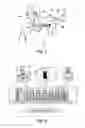 Fig. 02 - Device for optimization of sleep apnea syndrome therapy by kinesthetic stimulation