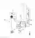 Fig. 02 - Non-invasive device for synchronizing chest compression and ventilation parameters to residual myocardial activity during cardiopulmonary resuscitation