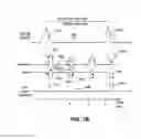 Fig. 10 - Non-invasive device for synchronizing chest compression and ventilation parameters to residual myocardial activity during cardiopulmonary resuscitation