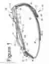 Fig. 02 - ELBOW DUAL COMPRESSION ARMBAND WITH INTERCHANGEABLE COMPRESSION PLATFORM