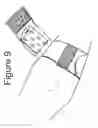 Fig. 09 - ELBOW DUAL COMPRESSION ARMBAND WITH INTERCHANGEABLE COMPRESSION PLATFORM
