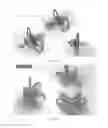 Fig. 07 - PACIFIER