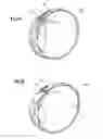 Fig. 04 - OCULAR THERAPEUTIC AGENT DELIVERY DEVICES AND METHODS FOR MAKING AND USING SUCH DEVICES