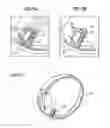 Fig. 17 - OCULAR THERAPEUTIC AGENT DELIVERY DEVICES AND METHODS FOR MAKING AND USING SUCH DEVICES
