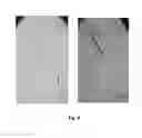 Fig. 05 - On demand vesicle formation from vesicle precursors suitable for long-term storage