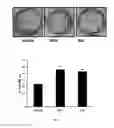 Fig. 04 - Pharmaceutical composition for the treatment of diminution of bone tissue