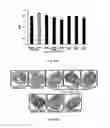Fig. 10 - Pharmaceutical composition for the treatment of diminution of bone tissue