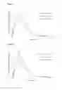 Fig. 04 - Encased tamper resistant controlled release dosage forms