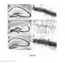 Fig. 10 - METHODS OF REDUCING BRAIN CELL APOPTOSIS